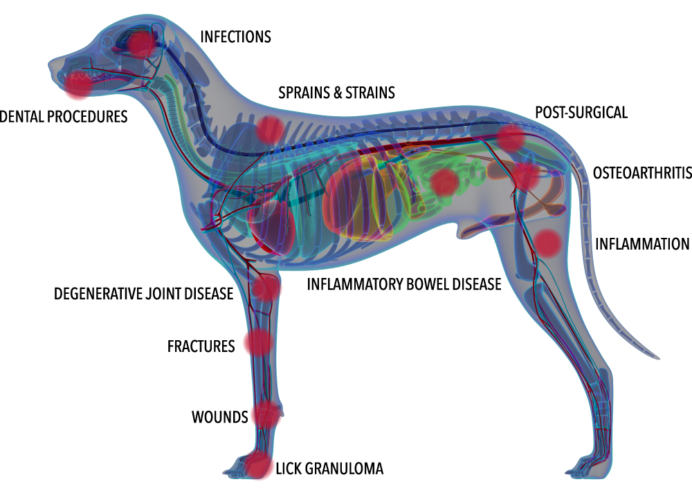 grade 4 laser therapy